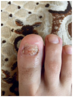 Иллюстрация к книге — Подология понятно. Важен каждый шаг. Справочник по проблемам подологии для клиентов и мастеров эстетики [i_199.jpg]