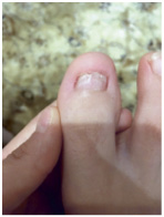 Иллюстрация к книге — Подология понятно. Важен каждый шаг. Справочник по проблемам подологии для клиентов и мастеров эстетики [i_202.jpg]