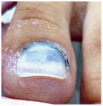 Иллюстрация к книге — Подология понятно. Важен каждый шаг. Справочник по проблемам подологии для клиентов и мастеров эстетики [i_203.jpg]