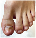 Иллюстрация к книге — Подология понятно. Важен каждый шаг. Справочник по проблемам подологии для клиентов и мастеров эстетики [i_204.jpg]