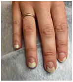 Иллюстрация к книге — Подология понятно. Важен каждый шаг. Справочник по проблемам подологии для клиентов и мастеров эстетики [i_206.jpg]