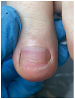 Иллюстрация к книге — Подология понятно. Важен каждый шаг. Справочник по проблемам подологии для клиентов и мастеров эстетики [i_213.jpg]