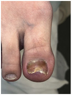 Иллюстрация к книге — Подология понятно. Важен каждый шаг. Справочник по проблемам подологии для клиентов и мастеров эстетики [i_215.jpg]