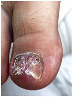 Иллюстрация к книге — Подология понятно. Важен каждый шаг. Справочник по проблемам подологии для клиентов и мастеров эстетики [i_216.jpg]