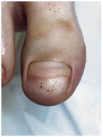 Иллюстрация к книге — Подология понятно. Важен каждый шаг. Справочник по проблемам подологии для клиентов и мастеров эстетики [i_224.jpg]