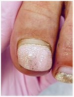 Иллюстрация к книге — Подология понятно. Важен каждый шаг. Справочник по проблемам подологии для клиентов и мастеров эстетики [i_226.jpg]