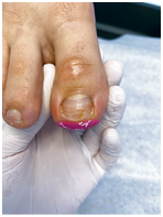 Иллюстрация к книге — Подология понятно. Важен каждый шаг. Справочник по проблемам подологии для клиентов и мастеров эстетики [i_232.jpg]