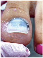 Иллюстрация к книге — Подология понятно. Важен каждый шаг. Справочник по проблемам подологии для клиентов и мастеров эстетики [i_237.jpg]