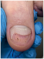 Иллюстрация к книге — Подология понятно. Важен каждый шаг. Справочник по проблемам подологии для клиентов и мастеров эстетики [i_244.jpg]