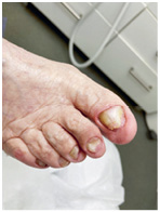 Иллюстрация к книге — Подология понятно. Важен каждый шаг. Справочник по проблемам подологии для клиентов и мастеров эстетики [i_254.jpg]