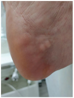 Иллюстрация к книге — Подология понятно. Важен каждый шаг. Справочник по проблемам подологии для клиентов и мастеров эстетики [i_268.jpg]