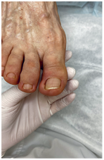 Иллюстрация к книге — Подология понятно. Важен каждый шаг. Справочник по проблемам подологии для клиентов и мастеров эстетики [i_269.jpg]