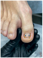 Иллюстрация к книге — Подология понятно. Важен каждый шаг. Справочник по проблемам подологии для клиентов и мастеров эстетики [i_276.jpg]