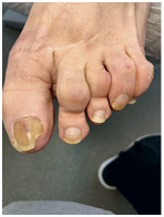 Иллюстрация к книге — Подология понятно. Важен каждый шаг. Справочник по проблемам подологии для клиентов и мастеров эстетики [i_278.jpg]