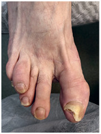 Иллюстрация к книге — Подология понятно. Важен каждый шаг. Справочник по проблемам подологии для клиентов и мастеров эстетики [i_281.jpg]