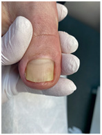 Иллюстрация к книге — Подология понятно. Важен каждый шаг. Справочник по проблемам подологии для клиентов и мастеров эстетики [i_295.jpg]