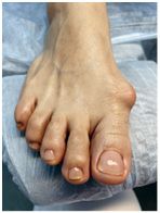 Иллюстрация к книге — Подология понятно. Важен каждый шаг. Справочник по проблемам подологии для клиентов и мастеров эстетики [i_302.jpg]