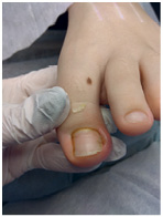 Иллюстрация к книге — Подология понятно. Важен каждый шаг. Справочник по проблемам подологии для клиентов и мастеров эстетики [i_306.jpg]