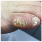 Иллюстрация к книге — Подология понятно. Важен каждый шаг. Справочник по проблемам подологии для клиентов и мастеров эстетики [i_313.jpg]