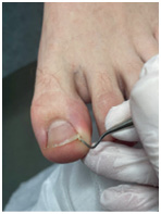 Иллюстрация к книге — Подология понятно. Важен каждый шаг. Справочник по проблемам подологии для клиентов и мастеров эстетики [i_329.jpg]