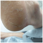 Иллюстрация к книге — Подология понятно. Важен каждый шаг. Справочник по проблемам подологии для клиентов и мастеров эстетики [i_336.jpg]