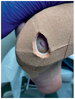 Иллюстрация к книге — Подология понятно. Важен каждый шаг. Справочник по проблемам подологии для клиентов и мастеров эстетики [i_342.jpg]