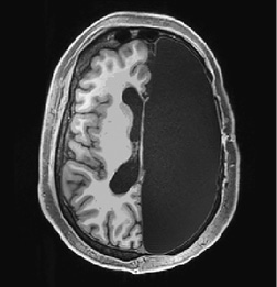 Иллюстрация к книге — Живой мозг. Удивительные факты о нейропластичности и возможностях мозга [img_1.jpg]